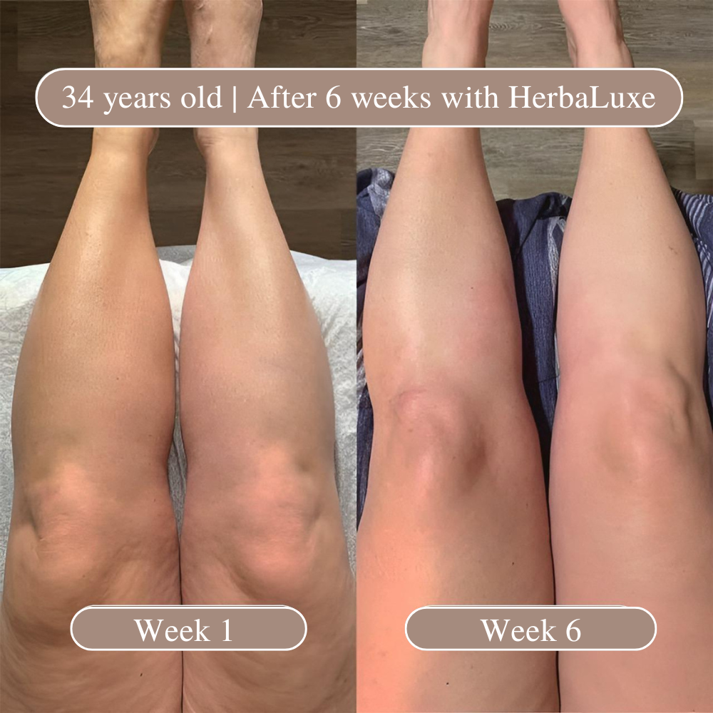 HerbaLuxe Anti-Cellulite Massage Oil