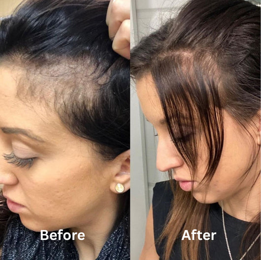 HerbaLuxe – Hair Growth & Anti-Hair Loss Set